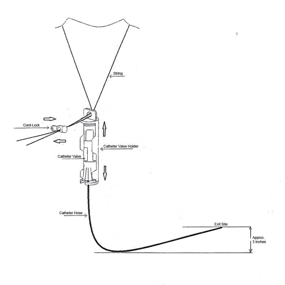 SecureWay Peritoneal Dialysis Catheter Holder Instructions Step 3